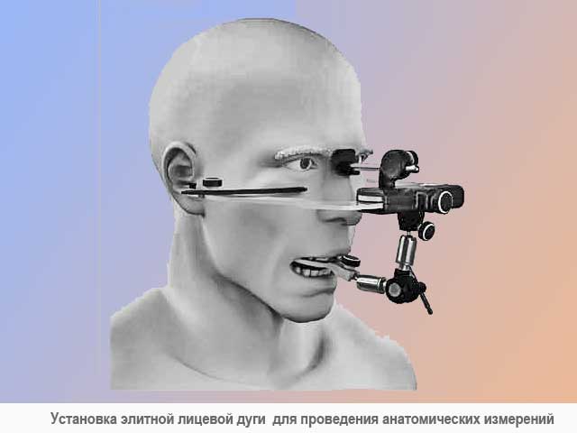 Лицевая дуга